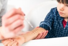 Allergien bei Kindern